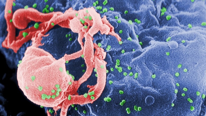 First Woman To Be 'Cured' Of HIV With Stem Cell Cancer Treatment