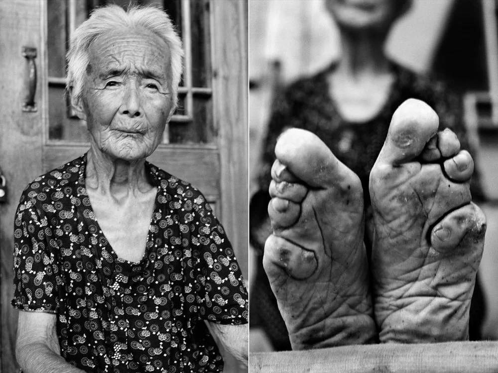 The Disturbing Tradition Of Foot Binding In China